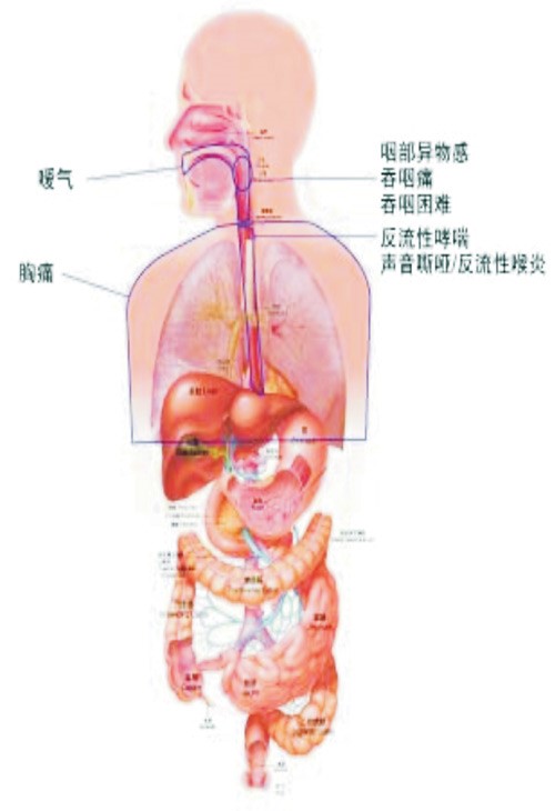 食管疼痛位置图图片