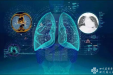 我院放射科人工智能肺结节筛查软件上线试运行