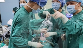 胃肠外科开展我院首例经脐单孔腹腔镜小肠肿瘤切除术