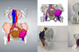 胃肠外科与医学3D打印中心医工结合实施肿瘤精准切除