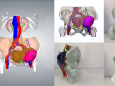 胃肠外科与医学3D打印中心医工结合实施肿瘤精准切除