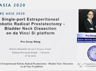 王东主任在世界机器人论坛上做“腹膜外入路单通道单孔技术机器人前列腺癌根治术”专题报告